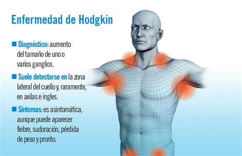 linfoma de hodgkin sintomas